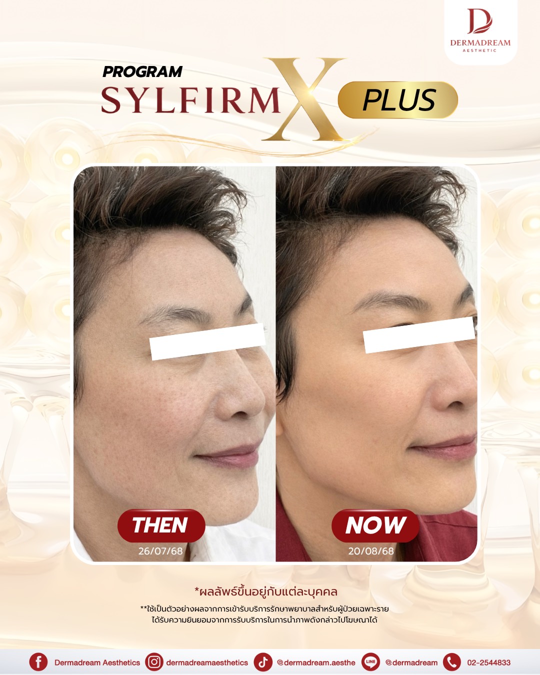 รีวิว Sylfirm X Plus: ชุดภาพที่ 2