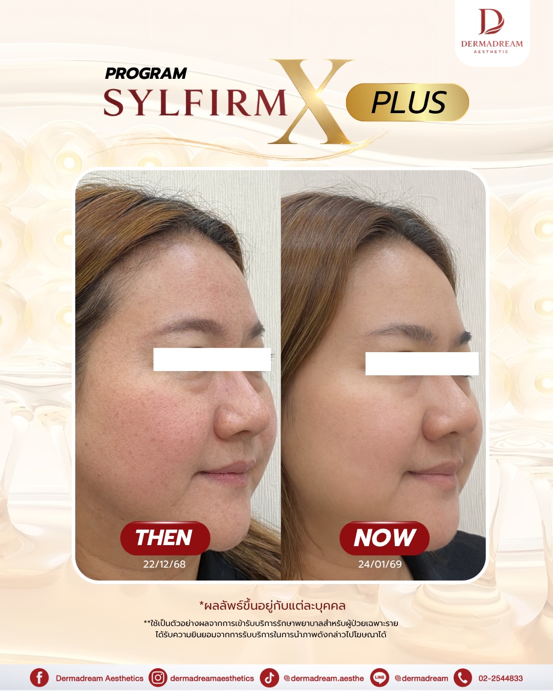 รีวิว Sylfirm X Plus: ชุดภาพที่ 3