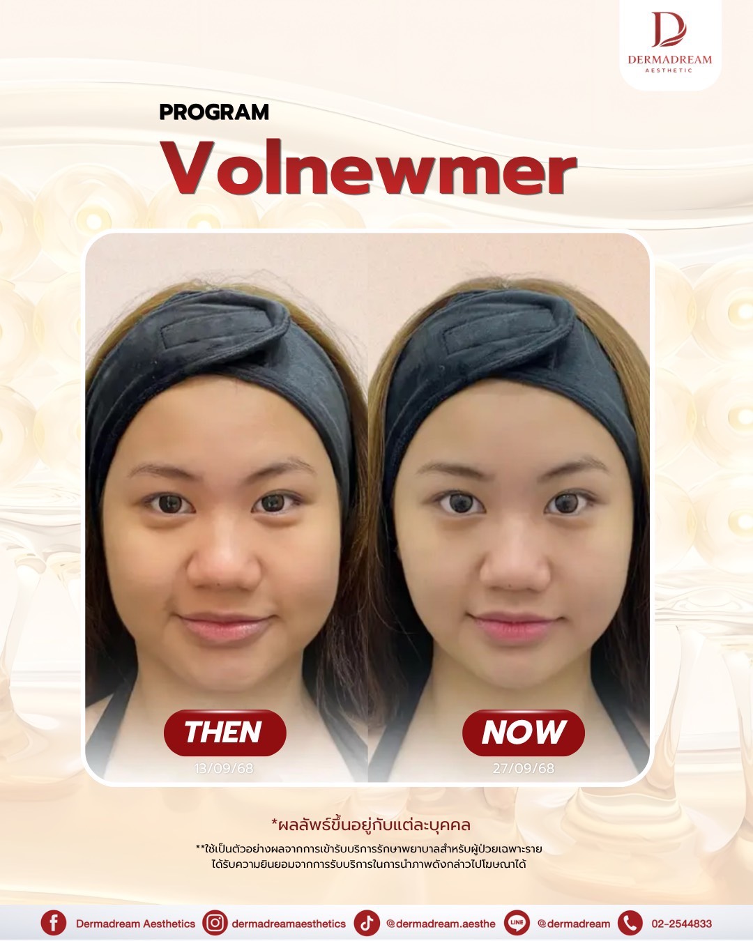 รีวิว Volnewmer: ชุดภาพที่ 2